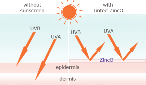 rosacea sunscreen - ZincO cream SPF 20